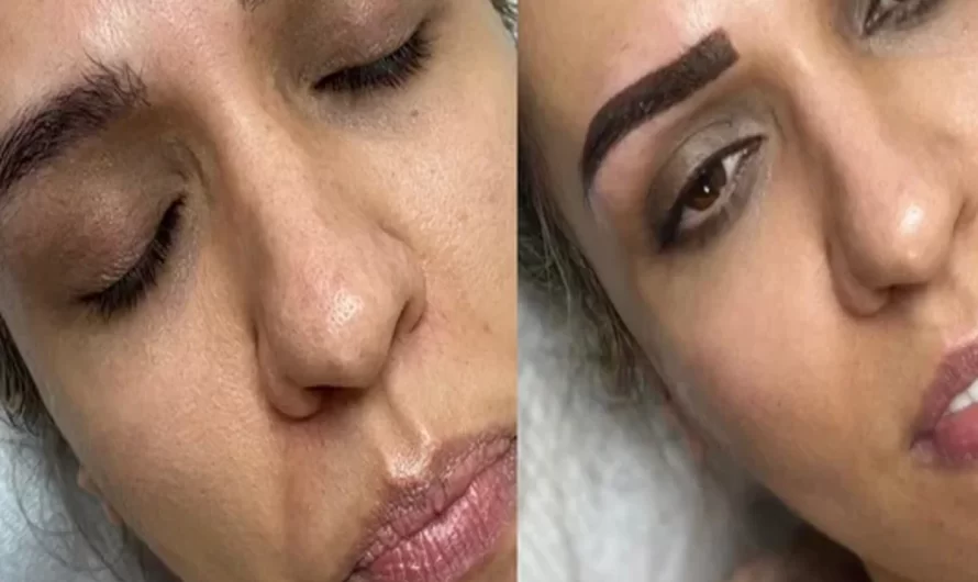 Eyebrow Tattooing