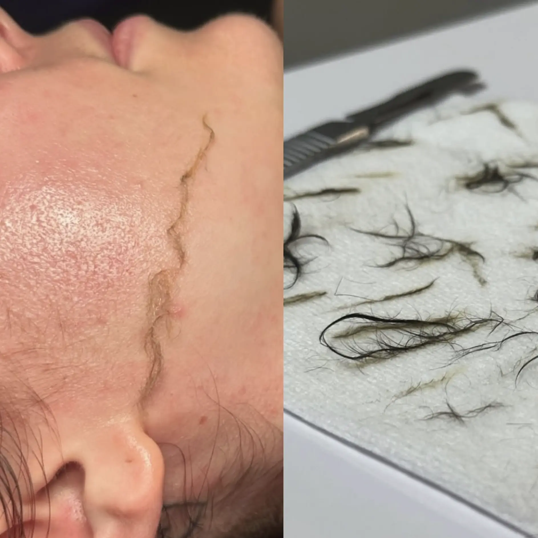 Brisbane humid skincare challenges