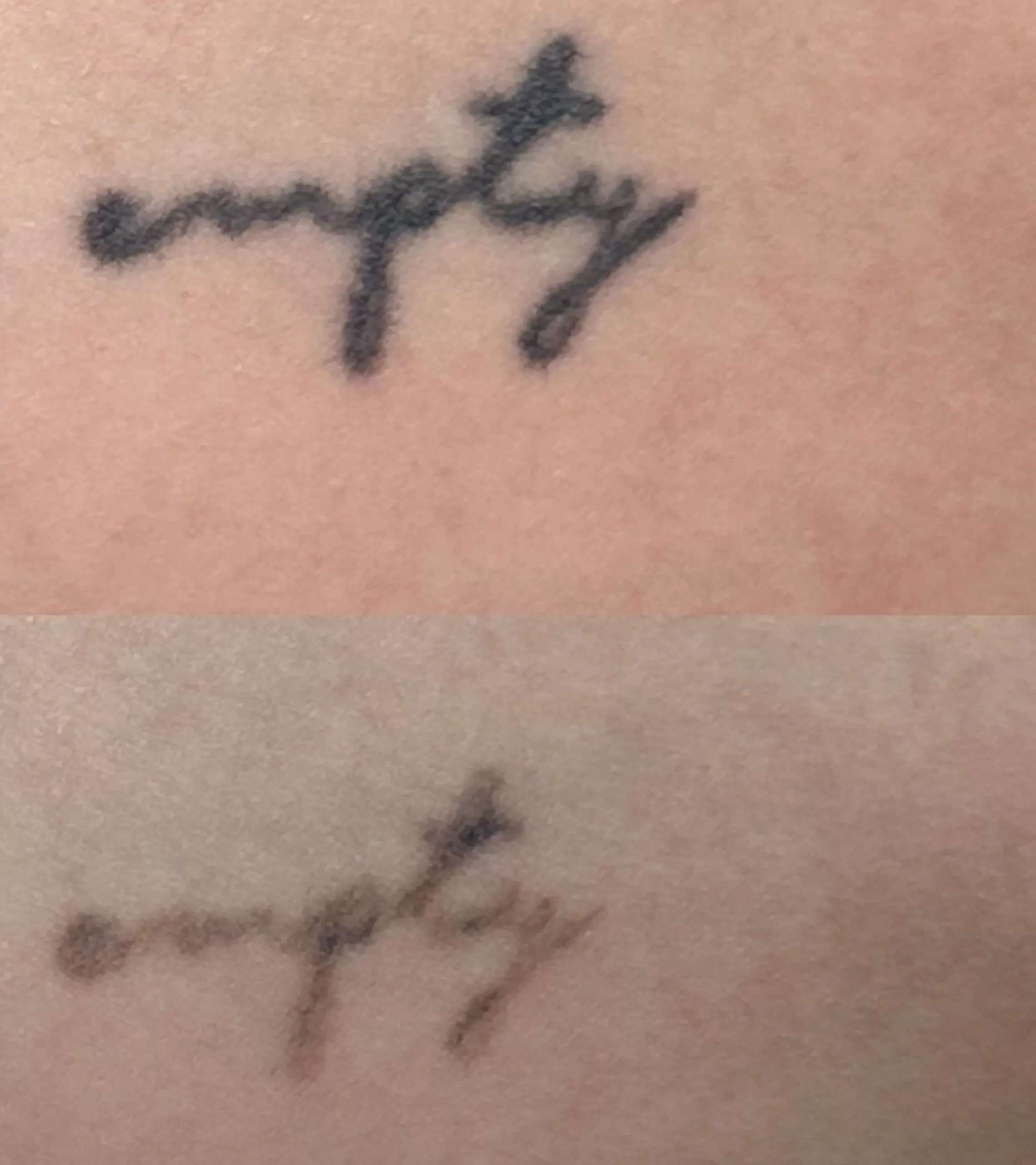 natural tattoo fading methods