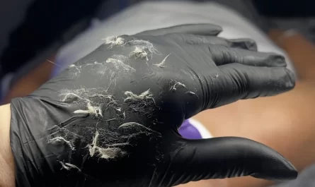 What is the downside of dermaplaning?